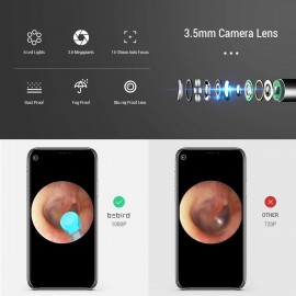 گوش پاک کن هوشمند دوربین دار مدل Bebird M9 Pro شیائومی - Xiaomi Bebird Smart Visual Ear Cleaning Rod M9 Pro