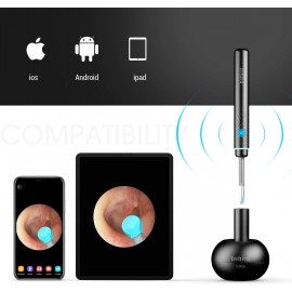 گوش پاک کن هوشمند دوربین دار مدل Bebird M9 Pro شیائومی - Xiaomi Bebird Smart Visual Ear Cleaning Rod M9 Pro