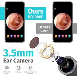 گوش پاک کن هوشمند دوربین دار مدل Bebird M9 Pro شیائومی - Xiaomi Bebird Smart Visual Ear Cleaning Rod M9 Pro